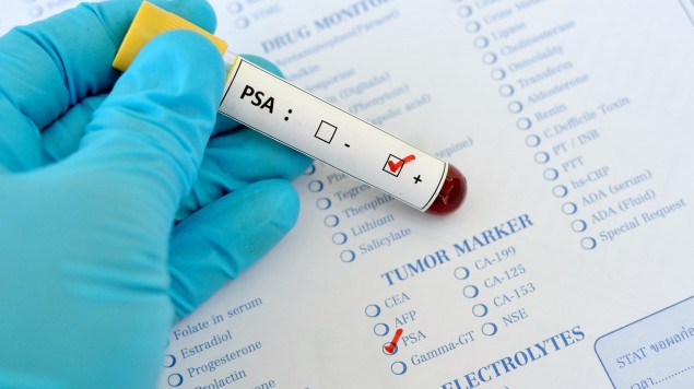 Description: https://womensjournalhealth.files.wordpress.com/2020/03/tumor-marker.jpg?w=635